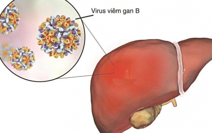 Bác sĩ cảnh báo bệnh viêm gan B và những lưu ý