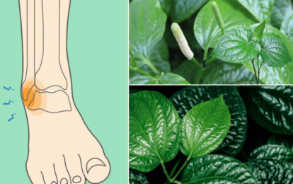 Bong gân chân nên đắp lá thuốc Y học cổ truyền gì để nhanh hồi phục?