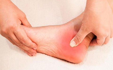 Giải pháp tự nhiên cho gai gót chân: Các bài thuốc Đông y hiệu quả