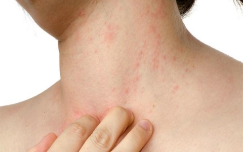 Chữa bệnh ngoài da bằng Đông y: Hướng đi an toàn, hiệu quả